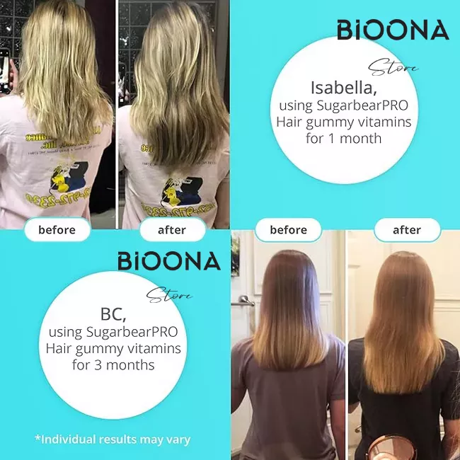 پاستیل تقویت مو شوگر بیر هیر (SugarBear Hair)