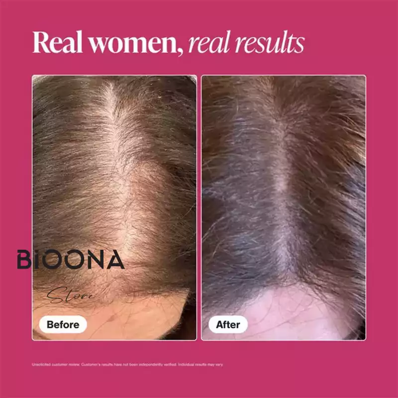 مکملی پیشرفته برای بازسازی و تقویت مو ویویسکال (Viviscal)