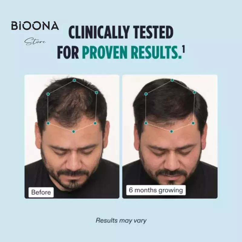 مکمل ضد ریزش مو نوترافول آقایان (Nutrafol Men)