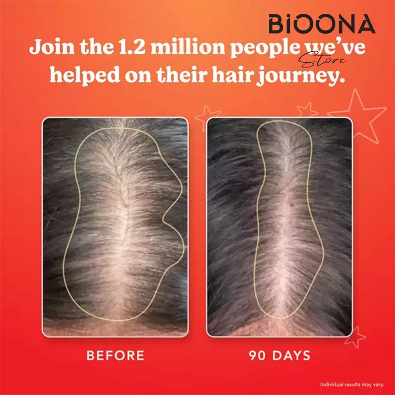 قرص هیرتامین اورجینال (Hairtamin Original)