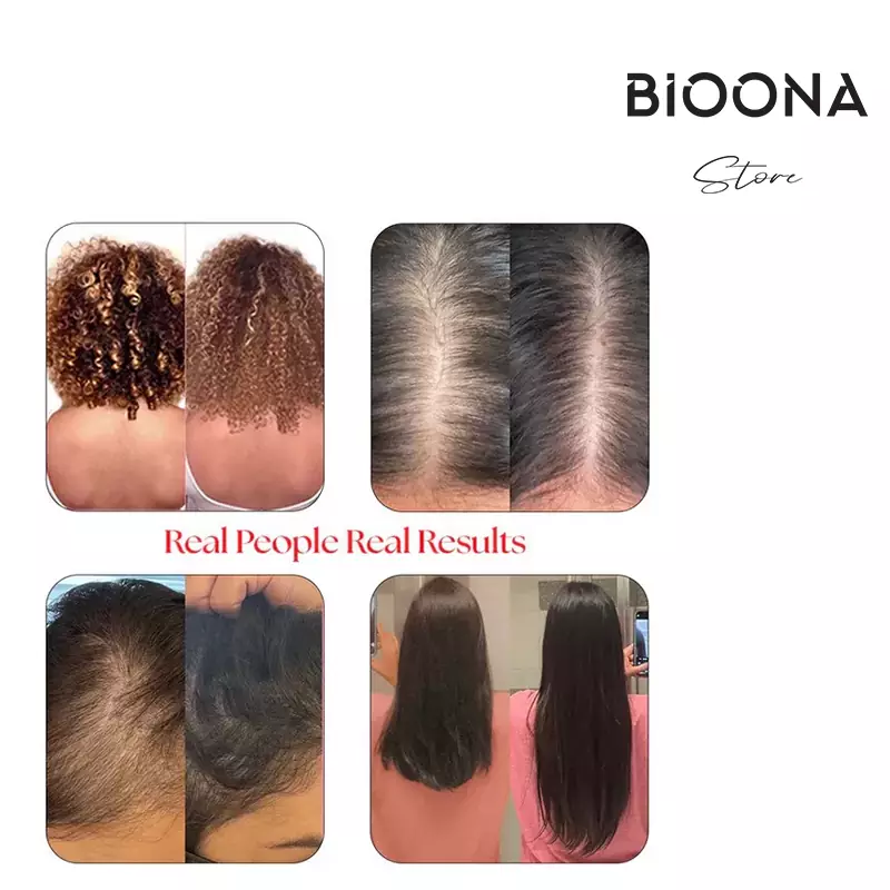 قرص هیرتامین اورجینال (Hairtamin Original)